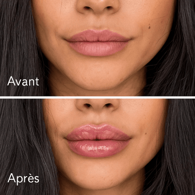 Lip Instant Volume - Aurel Beauty