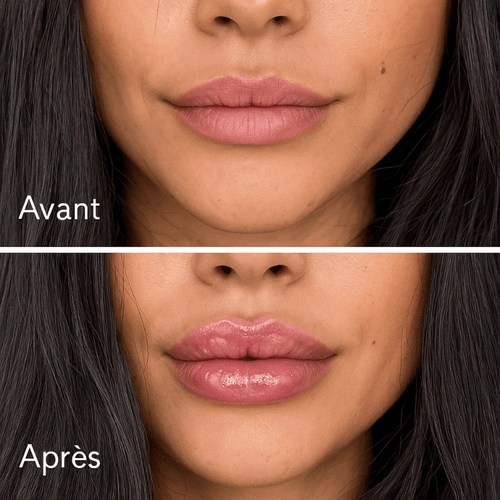 Lip Instant Volume