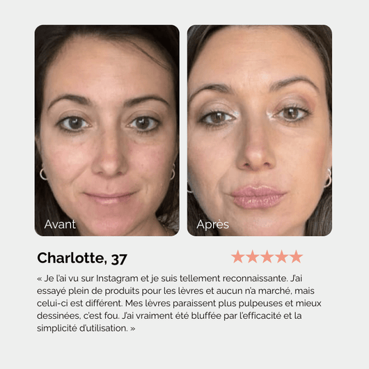 Lip Instant Volume - Aurel Beauty