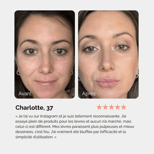Lip Instant Volume