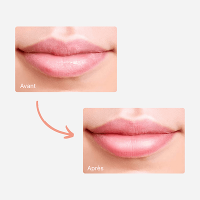 Lip Night Repair - Aurel Beauty